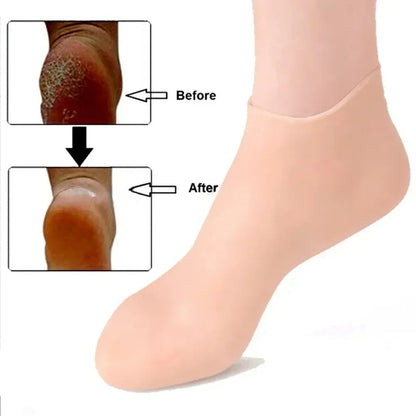 Pack of 2 – Silicone Moisturizing Foot Socks for Dry & Cracked Heels